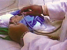 A baby who died in the Diwanyah hospital in Iraq for want of an oxygen mask  