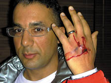 Gospel Oak councillor Keith Sedgwick raises a blooded hand 