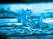 Syphilis, caused by treponema pallidum