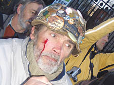 Protester Haw suffered a facial cut 
